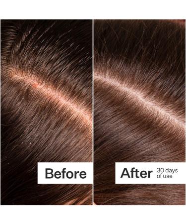 Shop Act+Acre Microbiome Cooling Scalp Serum For Dry Itchy Scalp + Loose Flakes - 2.2 oz Online - Best Price & International Shipping - Buy Online on SooperMarket.com