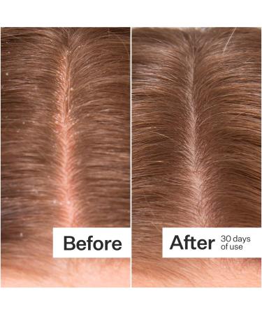 Shop Act+Acre Microbiome Cooling Scalp Serum For Dry Itchy Scalp + Loose Flakes - 2.2 oz Online - Best Price & International Shipping - Buy Online on SooperMarket.com