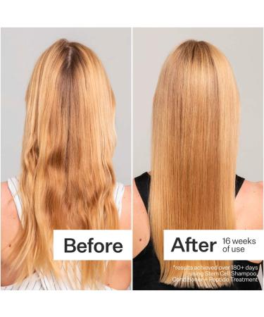 Shop Act+Acre Stem Cell Shampoo For Thicker+ Fuller-Looking Hair - 10 oz Online - Best Price & International Shipping - Buy Online on SooperMarket.com