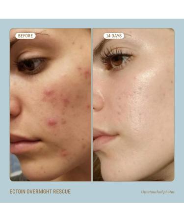 Shop Biossance Squalane + Ectoin Overnight Rescue Deep Repair Night Cream - 1.69 oz / 50 mL Online - Best Price & International Shipping - Buy Online on SooperMarket.com