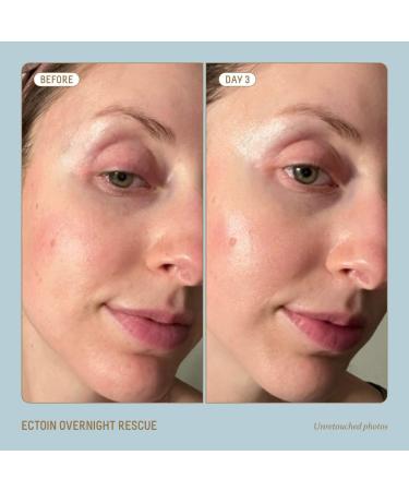 Shop Biossance Squalane + Ectoin Overnight Rescue Deep Repair Night Cream - 1.69 oz / 50 mL Online - Best Price & International Shipping - Buy Online on SooperMarket.com
