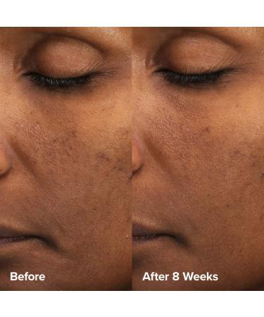 Shop Paula's Choice Skin Perfecting 6% Mandelic Acid + 2% Lactic Acid Liquid Exfoliant - 3 oz Online - Best Price & International Shipping - Buy Online on SooperMarket.com