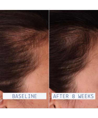 Shop AAVRANI Hair Density Boosting Scalp Serum for Thinning Hair & Hair Loss - 2 oz / 60 ml - 4 Month Supply Online - Best Price & International Shipping - Buy Online on SooperMarket.com