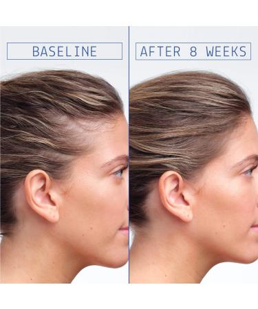 Shop AAVRANI Hair Density Boosting Scalp Serum for Thinning Hair & Hair Loss - 2 oz / 60 ml - 4 Month Supply Online - Best Price & International Shipping - Buy Online on SooperMarket.com