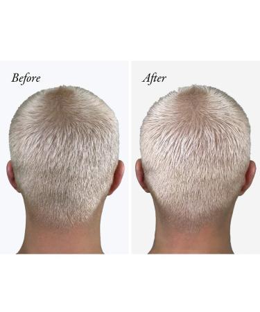 Shop Oribe Bright Blonde Radiance & Repair Hair Treatment - 5.9 oz/ 175 ml Online - Best Price & International Shipping - Buy Online on SooperMarket.com