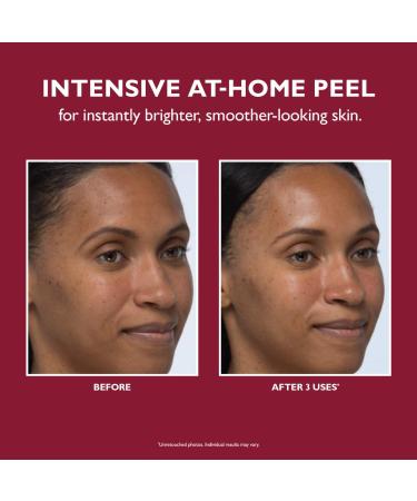Shop Peter Thomas Roth Even Smoother Instant Reveal Facial Peel - Pack of 8 Online - Best Price & International Shipping - Buy Online on SooperMarket.com