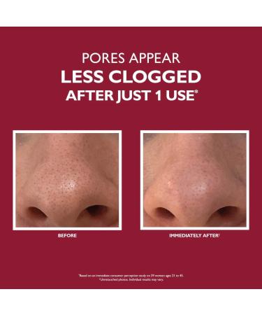 Shop Peter Thomas Roth Even Smoother Microdermabrasion Exfoliating Pore Purifier - 1.7 oz / 50 mL Online - Best Price & International Shipping - Buy Online on SooperMarket.com