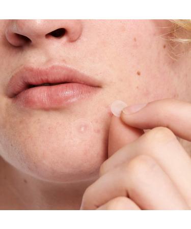 Shop The INKEY List Hydrocolloid Invisible Pimple Patches + Salicylic Acid Online - Best Price & International Shipping - Buy Online on SooperMarket.com