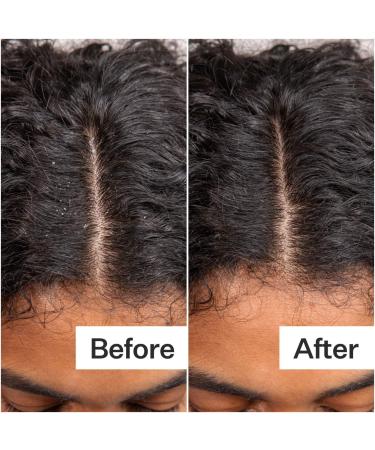 Shop Act+Acre Daily Hydro Scalp Serum with Hyaluronic Acid for Dry Scalp - 1 oz / 30 mL Online - Best Price & International Shipping - Buy Online on SooperMarket.com