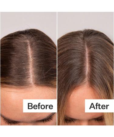Shop Act+Acre Daily Hydro Scalp Serum with Hyaluronic Acid for Dry Scalp - 1 oz / 30 mL Online - Best Price & International Shipping - Buy Online on SooperMarket.com