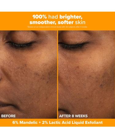 Shop Paula's Choice Brighter Days Ahead Kit with Vitamin C and AHA for Discoloration Online - Best Price & International Shipping - Buy Online on SooperMarket.com