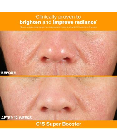 Shop Paula's Choice Brighter Days Ahead Kit with Vitamin C and AHA for Discoloration Online - Best Price & International Shipping - Buy Online on SooperMarket.com