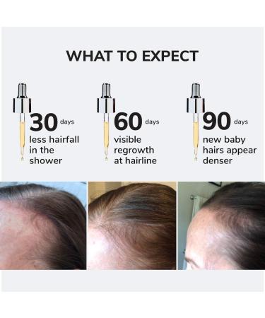 Shop COLOR WOW Youth Juice Collagen Scalp Serum for Thinning Hair - 1.7 oz / 50 mL Online - Best Price & International Shipping - Buy Online on SooperMarket.com