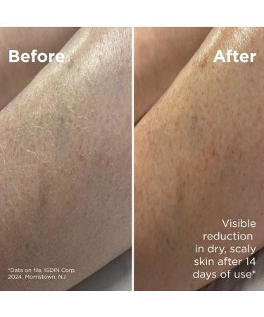 Shop ISDIN Uradin Lotion 10 Hydrating Body Lotion for Dry Skin - 13.5 oz / 400 ml Online - Best Price & International Shipping - Buy Online on SooperMarket.com