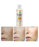Turmeric Dark Spot Corrector Toner 4oz - Facial Toner for Acne Prone Skin - Hydrating Dark Spot Remover for Women - Hyperpigmentation Treatment for Dry Oily Skin - Buy Online on SooperMarket.com