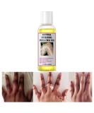 Peeling Oil for Dark Skin, Yellow Peeling Oil with Salicylic Sodium Hyaluronate, Strong Peeling Oil Extra Strength, Exfoliating Peeling Solution for Body All Skin Type - 110ML/3.66 OZ - Buy Online on SooperMarket.com