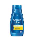 Selsun Blue Itchy Dry Scalp Anti-dandruff Shampoo  11 fl. oz.  Extra-Hydrating Formula  Pyrithione Zinc 1% - Buy Online on SooperMarket.com