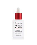 The Cr me Shop Korean Skin Care | What Acne - Hydrating & Healing Vitamin C Serum for Acne Treatment Dull Skin irritation Restoring Calming Pore Tightening - Buy Online on SooperMarket.com