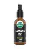 Organic Tamanu Oil - Natural Psoriasis Treatment Eczema Relief & Acne Scars - Cold Pressed & International Shipping - Buy Online on SooperMarket.com