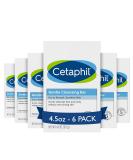 CETAPHIL Gentle Cleansing Bar, 4.5 oz Bar (Pack of 6), Nourishing Cleansing Bar For Dry, Sensitive Skin, Non-Comedogenic, (Packaging May Vary) - Buy Online on SooperMarket.com