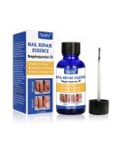 Premium Nail Care & Treatment | Repair Broken & Discolored Nails with Nourishing Nail Oil & Serum for Healthy Hands & Feet - Buy Online on SooperMarket.com