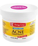 De La Cruz Sulfur Ointment - Cystic Acne Treatment - Cystic Acne Spot Treatment for Face and Body - Buy Online on SooperMarket.com