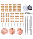 105-Piece Ingrown Toenail Tool Set | Complete Pedicure Kit with Correction Stickers Nail Tongs & Files for Perfect Toenail Care - Buy Online on SooperMarket.com