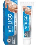 UpdateClassic Vitiligo Cream, Natural Vitiligo Treatment for Skin Vitiligo, Vitiligo Care Cream, Reduce White Spots and Improve Skin Pigmentation, Easy to Use, Blue/Vitiligo - Buy Online on SooperMarket.com