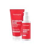 Neutrogena Stubborn Acne AM Face Treatment | Benzoyl Peroxide Formula - Buy Online on SooperMarket.com
