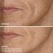 Discover BeautyBio GloPRO FACE MicroTip Attachment - Elevate Your Style Instantly! - Buy Online on SooperMarket.com