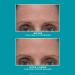 Discover Peter Thomas Roth Peptide Skinjection Amplified Wrinkle-Fix Serum 1.0 oz - Elevate Your Style Instantly! - Buy Online on SooperMarket.com