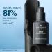 Discover Origins Clear Improvement Acne Clearing Hydrating Lotion 1.7 oz - Elevate Your Style Instantly! - Buy Online on SooperMarket.com