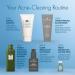 Discover Origins Clear Improvement Acne Clearing Hydrating Lotion 1.7 oz - Elevate Your Style Instantly! - Buy Online on SooperMarket.com