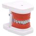 LBYYH Teeth Orthodontic model demonstration model dental model of the exercise to communicate oral demonstrations with patients at school