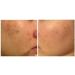 Avene Cicalfate Repair Cream Hypoallergenic for Sensitive & Irritated Skin 100 ml - Buy Online on SooperMarket.com