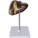 Human Liver Pathological Model with Base On Support Tool Study On Medical Model Internal - Buy Online on SooperMarket.com