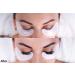 Extra Strong Professional Eyelash Extension Glue - 1-2s Drying Time with 6-7 Week Retention - 5ml by Existing Beauty Lashes - Buy Online on SooperMarket.com