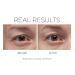 COSMEDIX Opti Crystal Liquid Crystal Eye Serum 0.25 Fl Oz | Reduce Dark Circles | Improve Fine Lines & Wrinkles | Cruelty-Free & Gluten Free - Buy Online on SooperMarket.com