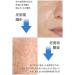 Medicube Zero Pore Pad - Buy Online on SooperMarket.com