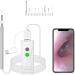 Jteremy 3.9mm HD WiFi Ear Endoscope for Ear Wax Removal - Visual Inspection Camera with LED Lights for Kids, Adults, Pets - Buy Online on SooperMarket.com