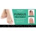 Karlash Extra Strong Nail Fungus Treatment Kit - Made in USA - 0.5oz - For Nails and Toes - Buy Online on SooperMarket.com