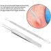 Blackhead & Pimple Removal Tool Stainless Steel Blackhead Removal Tool Kit Curved Tweezers+Looped Double-end Pimple Extractor - Buy Online on SooperMarket.com