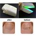 Rechargeable Nail Fungus Laser Treatment Onychomycosis Treatment for Onychomycosis Cure and Home Use - Buy Online on SooperMarket.com