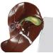 Human Liver Pathological Model with Base On Support Tool Study On Medical Model Internal - Buy Online on SooperMarket.com