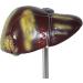 Human Liver Pathological Model with Base On Support Tool Study On Medical Model Internal - Buy Online on SooperMarket.com