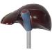 Human Liver Pathological Model with Base On Support Tool Study On Medical Model Internal - Buy Online on SooperMarket.com