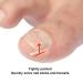 60+2 Pack Ingrown Toenail Treatment Set - Includes Corrector Strips, Lifter, and Nail Clipper - Professional Ingrown Toenail Correction Tool - Buy Online on SooperMarket.com