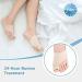 Silicone Hallux Valgus Corrector and Toe Separator - Bunion Orthopedic Corrector Set with Toe Correction Belt for Day and Night Wear - Buy Online on SooperMarket.com