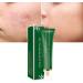 Acne Scar Removal Gel Face Body Marks Skin Repair Cream Acne Treatment Essence 30g acne removal cream - Buy Online on SooperMarket.com