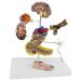 Model of Diabetes Model of complications Brain Heart Pancreas neurone Foot Patient Patient Doctor aids to The Demonstration of Diabetes